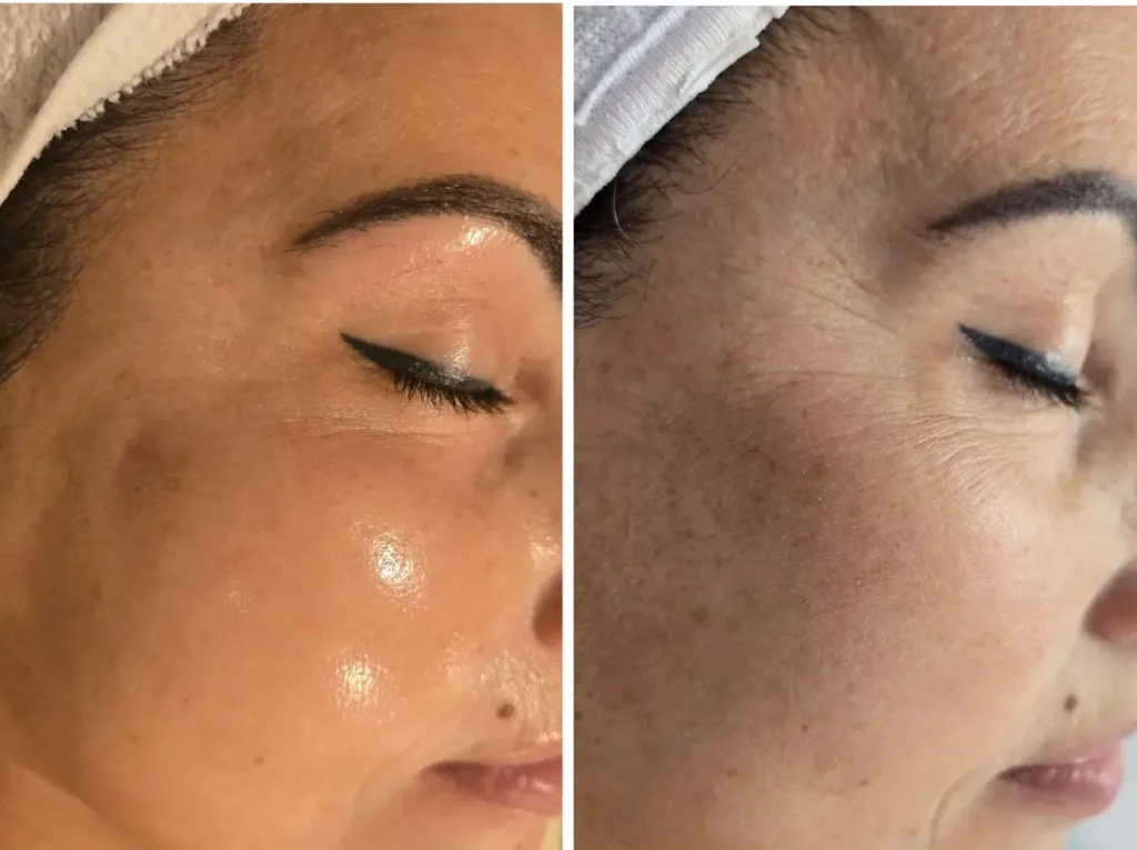 J.A. Esthetics